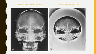 IMAGE WITHOUT CONE USE. IMAGE WITH CONE USE
 