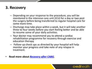 Beating Heart Bypass Surgery - Beating Heart Bypass Surgery Things You Should Know 10 320 