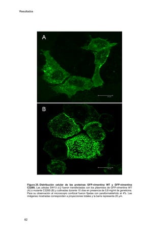 Resultados
Figura 25. Distribución celular de las proteínas GFP-vimentina WT y GFP-vimentina
C328S. Las células SW13 cl.2 fueron transfectadas con los plásmidos de GFP-vimentina WT
(A) o mutante C328S (B) y cultivadas durante 10 días en presencia de 0,8 mg/ml de geneticina.
Para su observación al microscopio confocal fueron fijadas con paraformaldehído al 4%. Las
imágenes mostradas corresponden a proyecciones totales y la barra representa 20 μm.
82
 