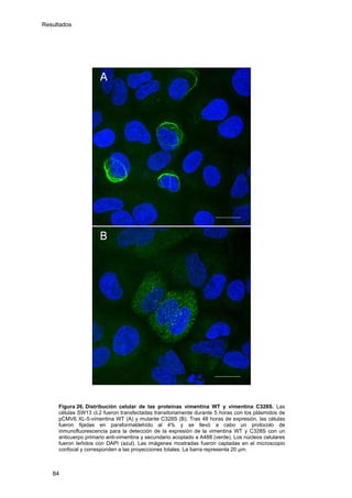 Resultados
Figura 26. Distribución celular de las proteínas vimentina WT y vimentina C328S. Las
células SW13 cl.2 fueron transfectadas transitoriamente durante 5 horas con los plásmidos de
pCMV6 XL-5-vimentina WT (A) y mutante C328S (B). Tras 48 horas de expresión, las células
fueron fijadas en paraformaldehído al 4% y se llevó a cabo un protocolo de
inmunofluorescencia para la detección de la expresión de la vimentina WT y C328S con un
anticuerpo primario anti-vimentina y secundario acoplado a A488 (verde). Los núcleos celulares
fueron teñidos con DAPI (azul). Las imágenes mostradas fueron captadas en el microscopio
confocal y corresponden a las proyecciones totales. La barra representa 20 μm.
84
 