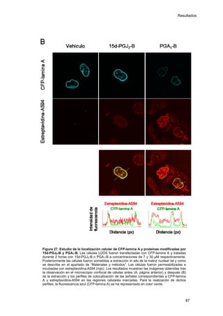 Resultados
Figura 27. Estudio de la localización celular de CFP-lamina A y proteínas modificadas por
15d-PGJ2-B y PGA1-B. Las células U2OS fueron transfectadas con CFP-lamina A y tratadas
durante 2 horas con 15d-PGJ2-B o PGA1-B a concentraciones de 7 y 30 µM respectivamente.
Posteriormente las células fueron sometidas a extracción in situ de la matriz nuclear tal y como
se describe en el apartado de “Materiales y métodos”. Las células fueron permeabilizadas e
incubadas con estreptavidina-A594 (rojo). Los resultados muestran las imágenes obtenidas tras
la observación en el microscopio confocal de células antes (A, página anterior) y después (B)
de la extracción y los perfiles de colocalización de las señales correspondientes a CFP-lamina
A y estreptavidina-A594 en las regiones celulares marcadas. Para la realización de dichos
perfiles, la fluorescencia azul (CFP-lamina A) se ha representado en color verde.
87
 