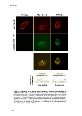 Resultados
Figura 28. Localización de las laminas A y C endógenas y proteínas modificadas por las
cyPG biotiniladas en la envuelta nuclear. Las células U2OS fueron tratadas durante 2 horas
con 15d-PGJ2-B o PGA1-B a concentraciones de 7 y 30 µM respectivamente o con un volumen
equivalente de vehículo y sometidas a extracción in situ de la matriz nuclear. Las células se
sometieron a inmunofluorescencia con anticuerpo anti-lamina A/C y anticuerpo secundario
acoplado a A633 (rojo), y fueron incubadas simultáneamente con estreptavidina acoplada a
FITC (verde). Se muestran imágenes del microscopio confocal y de los perfiles de
colocalización de las señales de las laminas A y C marcadas con A633 y de estreptavidina-
FITC en las regiones celulares señaladas.
88
 