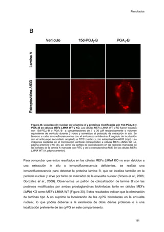 Resultados
Figura 29. Localización nuclear de la lamina A y proteínas modificadas por 15d-PGJ2-B y
PGA1-B en células MEFs LMNA WT y KO. Las células MEFs LMNA WT y KO fueron tratadas
con 15d-PGJ2-B o PGA1-B a concentraciones de 7 y 30 µM respectivamente o volumen
equivalente de vehículo durante 2 horas y sometidas al protocolo de extracción in situ. Se
llevaron a cabo inmunofluorescencias con el anticuerpo anti-lamina A seguido de incubación
con el anticuerpo secundario acoplado a FITC (verde) y con estreptavidina-A633 (rojo). Las
imágenes captadas en el microscopio confocal corresponden a células MEFs LMNA WT (A,
página anterior) y KO (B), así como los perfiles de colocalización en las regiones marcadas de
las señales de la lamina A marcada con FITC y de la estreptavidina-A633 en las células MEFs
LMNA WT (A, página anterior).
Para comprobar que estos resultados en las células MEFs LMNA KO no eran debidos a
una extracción in situ o inmunofluorescencia deficientes, se realizó una
inmunofluorescencia para detectar la proteína lamina B, que se localiza también en la
periferia nuclear y sirve por tanto de marcador de la envuelta nuclear (Broers et al., 2006;
Gonzalez et al., 2008). Observamos un patrón de colocalización de lamina B con las
proteínas modificadas por ambas prostaglandinas biotiniladas tanto en células MEFs
LMNA KO como MEFs LMNA WT (Figura 30). Estos resultados indican que la eliminación
de laminas tipo A no suprime la localización de las cyPG biotiniladas en la envuelta
nuclear, lo que podría deberse a la existencia de otras dianas proteicas o a una
localización preferente de las cyPG en este compartimento.
91
 