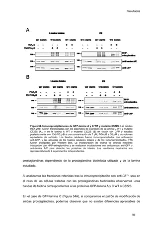 Resultados
Figura 34. Inmunoprecipitaciones de GFP-lamina A y C WT y mutante C522S. Las células
HEK-293T fueron transfectadas con los plásmidos de expresión de la lamina C WT y mutante
C522S (A), y de la lamina A WT y mutante C522S (B) en fusión con GFP y tratadas
posteriormente con 15d-PGJ2-B a una concentración de 7 µM, PGA1-B a 30 µM o un volumen
equivalente de vehículo. Los lisados celulares fueron inmunoprecipitados con anticuerpo
anti-GFP, y las alícuotas de los lisados celulares totales y de los inmunoprecipitados (FR)
fueron analizadas por Western Blot. La incorporación de biotina se detectó mediante
incubación con HRP-estreptavidina y se realizaron incubaciones con anticuerpos anti-GFP y
anti-lamina A/C para detectar las proteínas de interés. Los resultados mostrados son
representativos de 2 experimentos independientes.
prostaglandinas dependiendo de la prostaglandina biotinilada utilizada y de la lamina
estudiada.
Si analizamos las fracciones retenidas tras la inmunoprecipitación con anti-GFP, solo en
el caso de las células tratadas con las prostaglandinas biotiniladas observamos unas
bandas de biotina correspondientes a las proteínas GFP-lamina A y C WT o C522S.
En el caso de GFP-lamina C (Figura 34A), si comparamos el patrón de modificación de
ambas prostaglandinas, podemos observar que no existen diferencias apreciables de
99
 