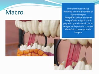 Macro
comúnmente se hace
referencia con ese nombre al
tipo de imagen
fotográfica donde el sujeto
fotografiado es igual o más
pequeño que el tamaño de su
imagen en la película o sensor
electrónico que captura la
imagen
 