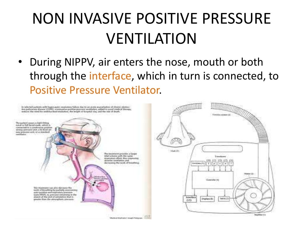 Noninvasive Ventilation