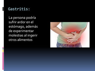 Gastritis:
La persona podría
sufrir ardor en el
estómago, además
de experimentar
molestias al ingerir
otros alimentos
 