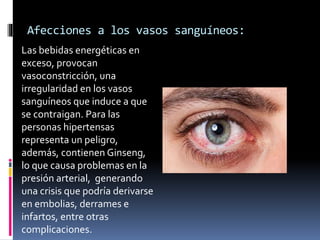 Afecciones a los vasos sanguíneos:
Las bebidas energéticas en
exceso, provocan
vasoconstricción, una
irregularidad en los vasos
sanguíneos que induce a que
se contraigan. Para las
personas hipertensas
representa un peligro,
además, contienen Ginseng,
lo que causa problemas en la
presión arterial, generando
una crisis que podría derivarse
en embolias, derrames e
infartos, entre otras
complicaciones.
 