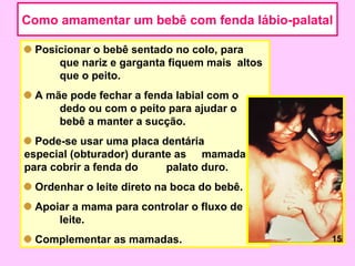 Como amamentar um bebê com fenda lábio-palatal

 Posicionar o bebê sentado no colo, para
     que nariz e garganta fiquem mais altos
     que o peito.
 A mãe pode fechar a fenda labial com o
     dedo ou com o peito para ajudar o
     bebê a manter a sucção.
  Pode-se usar uma placa dentária
especial (obturador) durante as mamadas
para cobrir a fenda do     palato duro.
 Ordenhar o leite direto na boca do bebê.
 Apoiar a mama para controlar o fluxo de
     leite.
 Complementar as mamadas.                     15
 