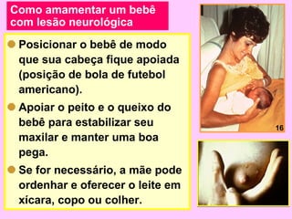 Como amamentar um bebê
com lesão neurológica
 Posicionar o bebê de modo
 que sua cabeça fique apoiada
 (posição de bola de futebol
 americano).
 Apoiar o peito e o queixo do
 bebê para estabilizar seu        16
 maxilar e manter uma boa
 pega.
 Se for necessário, a mãe pode
 ordenhar e oferecer o leite em
 xícara, copo ou colher.
 