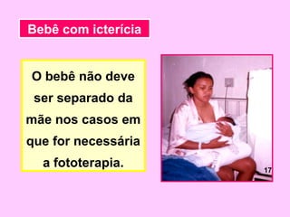 Bebê com icterícia


O bebê não deve
 ser separado da
mãe nos casos em
que for necessária
  a fototerapia.     17
 