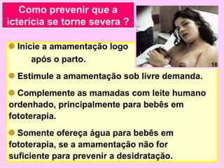 Como prevenir que a
icterícia se torne severa ?

  Inicie a amamentação logo
      após o parto.
                                              18

  Estimule a amamentação sob livre demanda.
  Complemente as mamadas com leite humano
ordenhado, principalmente para bebês em
fototerapia.
  Somente ofereça água para bebês em
fototerapia, se a amamentação não for
suficiente para prevenir a desidratação.
 