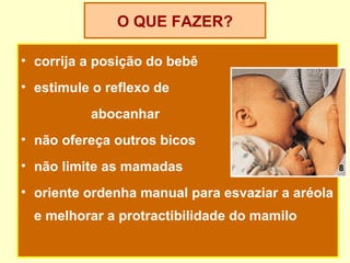 O QUE FAZER?

• corrija a posição do bebê
• estimule o reflexo de
          abocanhar
• não ofereça outros bicos
• não limite as mamadas                           8

• oriente ordenha manual para esvaziar a aréola
  e melhorar a protractibilidade do mamilo
 