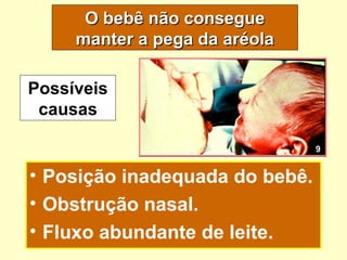 O bebê não consegue
     manter a pega da aréola

Possíveis
 causas

                                9


• Posição inadequada do bebê.
• Obstrução nasal.
• Fluxo abundante de leite.
 