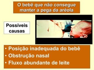 O bebê que não consegue manter a pega da aréola Posição inadequada do bebê Obstrução nasal Fluxo abundante de leite Possíveis causas 