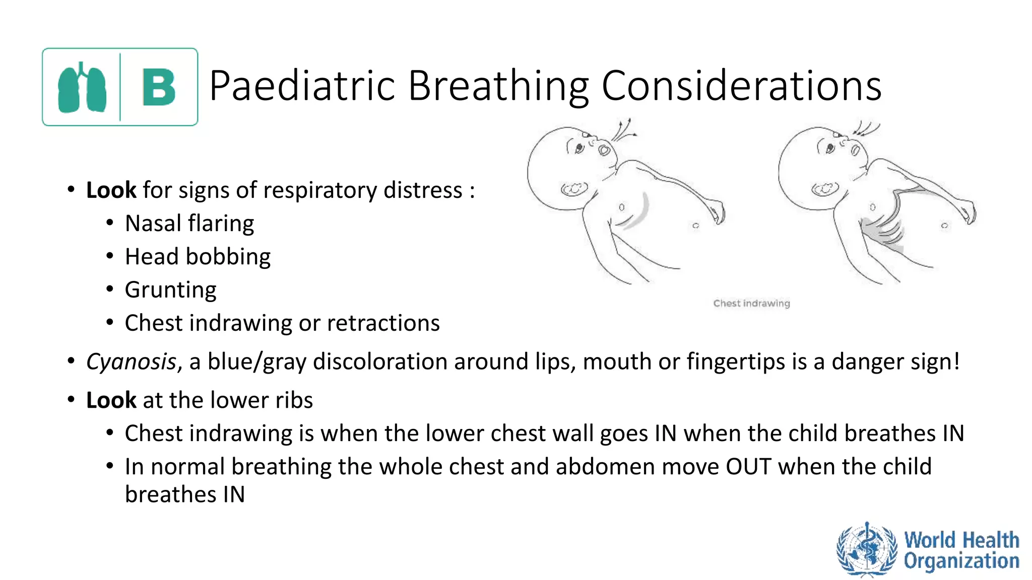 Paediatric Breathing Considerations
• Look for signs of respiratory distress :
• Nasal flaring
• Head bobbing
• Grunting
• Chest indrawing or retractions
• Cyanosis, a blue/gray discoloration around lips, mouth or fingertips is a danger sign!
• Look at the lower ribs
• Chest indrawing is when the lower chest wall goes IN when the child breathes IN
• In normal breathing the whole chest and abdomen move OUT when the child
breathes IN
 