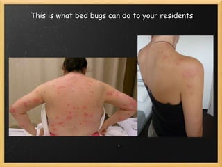 This is what bed bugs can do to your residents 
