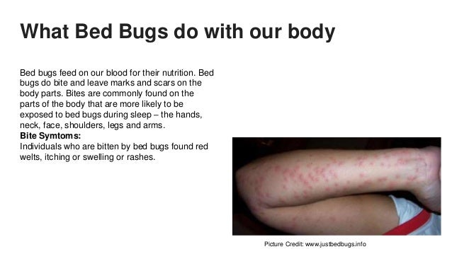 bed bug bite effects bed bug treatment bed bug bite effects bed bug treatment