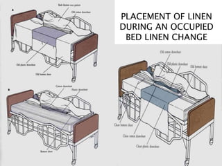PLACEMENT OF LINEN
DURING AN OCCUPIED
BED LINEN CHANGE
 
