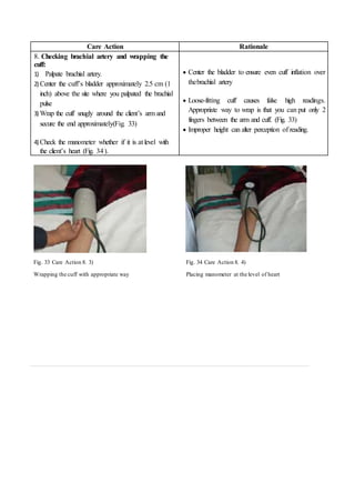 Care Action Rationale
8. Checking brachial artery and wrapping the
cuff:
1) Palpate brachial artery.
2) Center the cuff’s bladder approximately 2.5 cm (1
inch) above the site where you palpated the brachial
pulse
3) Wrap the cuff snugly around the client’s arm and
secure the end approximately(Fig. 33)
4) Check the manometer whether if it is at level with
the client’s heart (Fig. 34).
 Center the bladder to ensure even cuff inflation over
thebrachial artery
 Loose-fitting cuff causes false high readings.
Appropriate way to wrap is that you can put only 2
fingers between the arm and cuff. (Fig. 33)
 Improper height can alter perception of reading.
Fig. 33 Care Action 8. 3)
Wrapping the cuff with appropriate way
Fig. 34 Care Action 8. 4)
Placing manometer at the level of heart
 