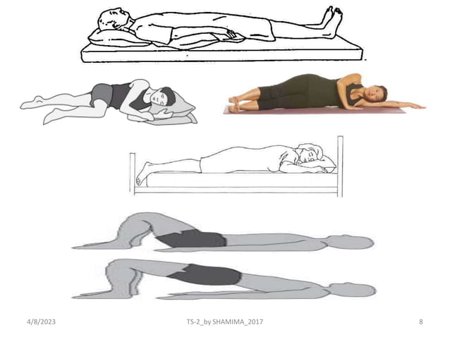 BED MOBILITY.pptx