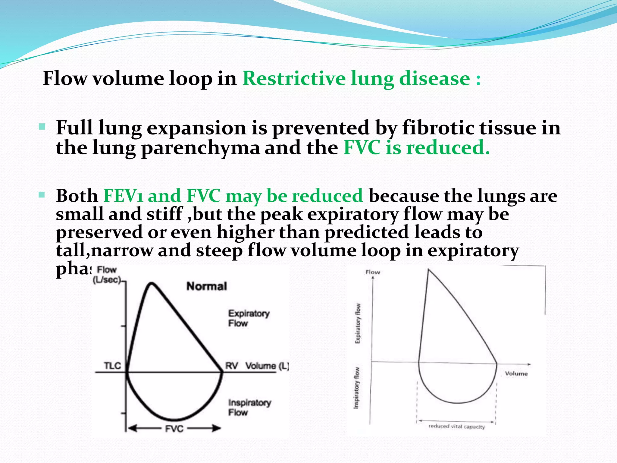 Flow volume loop in Restrictive lung disease :
 Full lung expansion is prevented by fibrotic tissue in
the lung parenchyma and the FVC is reduced.
 Both FEV1 and FVC may be reduced because the lungs are
small and stiff ,but the peak expiratory flow may be
preserved or even higher than predicted leads to
tall,narrow and steep flow volume loop in expiratory
phase.
 