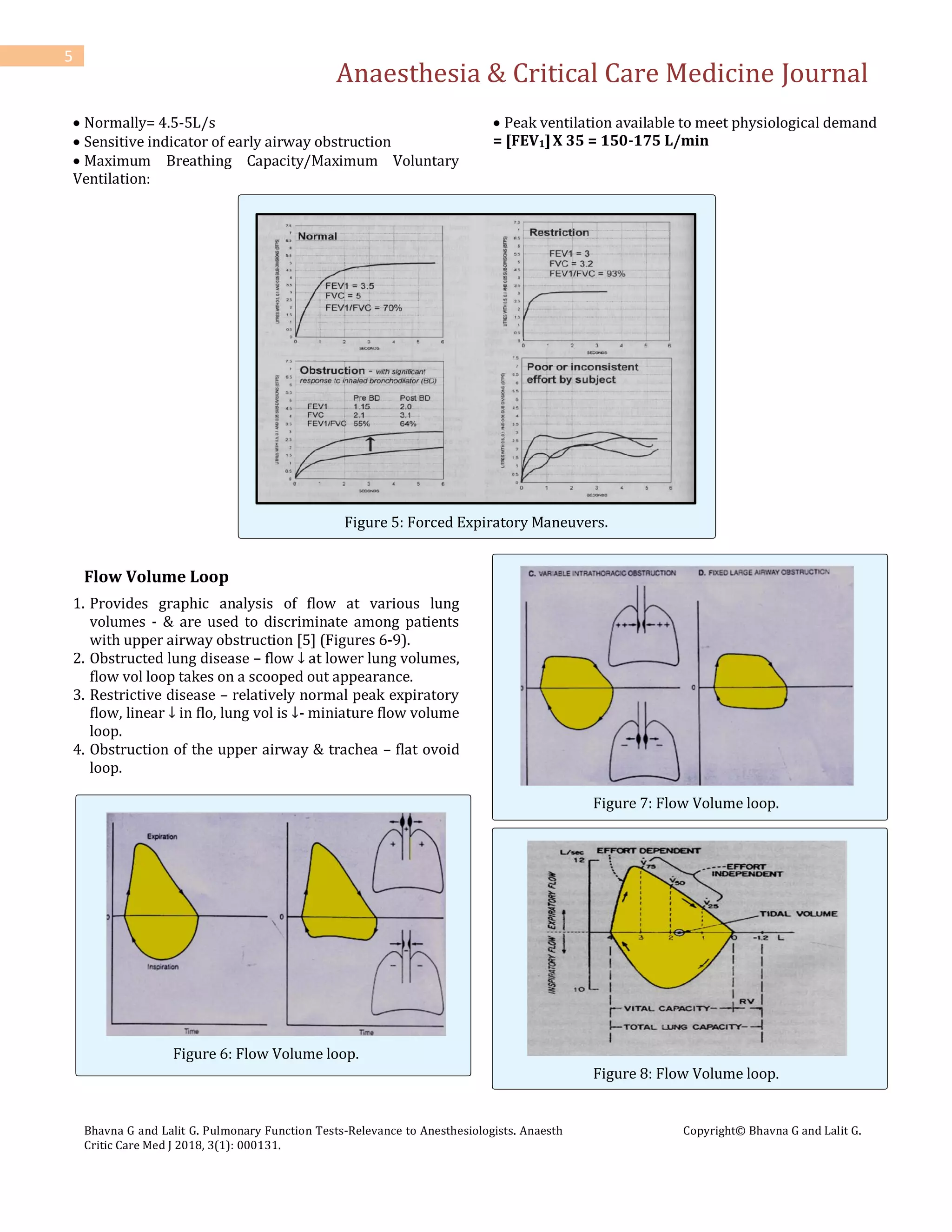 Anaesthesia & Critical Care Medicine Journal
Bhavna G and Lalit G. Pulmonary Function Tests-Relevance to Anesthesiologists. Anaesth
Critic Care Med J 2018, 3(1): 000131.
Copyright© Bhavna G and Lalit G.
5
 Normally= 4.5-5L/s
 Sensitive indicator of early airway obstruction
 Maximum Breathing Capacity/Maximum Voluntary
Ventilation:
 Peak ventilation available to meet physiological demand
= [FEV1]X 35 = 150-175 L/min
Figure 5: Forced Expiratory Maneuvers.
Flow Volume Loop
1. Provides graphic analysis of flow at various lung
volumes - & are used to discriminate among patients
with upper airway obstruction [5] (Figures 6-9).
2. Obstructed lung disease – flow ↓ at lower lung volumes,
flow vol loop takes on a scooped out appearance.
3. Restrictive disease – relatively normal peak expiratory
flow, linear ↓ in flo, lung vol is ↓- miniature flow volume
loop.
4. Obstruction of the upper airway & trachea – flat ovoid
loop.
Figure 6: Flow Volume loop.
Figure 7: Flow Volume loop.
Figure 8: Flow Volume loop.
 