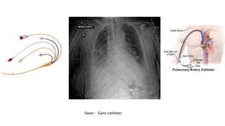 Swan - Ganz catheter
 
