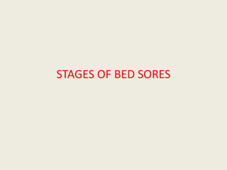 STAGES OF BED SORES
 