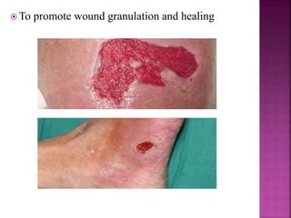  To promote wound granulation and healing
 
