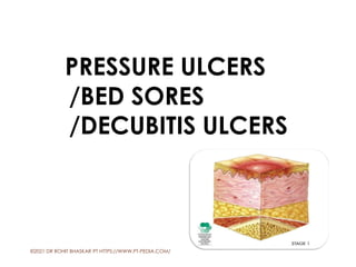 PRESSURE ULCERS
/BED SORES
/DECUBITIS ULCERS
©2021 DR ROHIT BHASKAR PT HTTPS://WWW.PT-PEDIA.COM/ 1
 