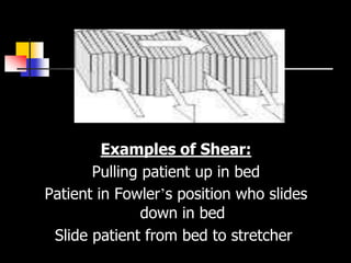 Examples of Shear:
       Pulling patient up in bed
Patient in Fowler’s position who slides
               down in bed
 Slide patient from bed to stretcher.
 