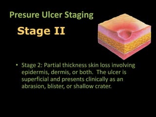 Presure Ulcer Staging
 Stage II


 • Stage 2: Partial thickness skin loss involving
   epidermis, dermis, or both. The ulcer is
   superficial and presents clinically as an
   abrasion, blister, or shallow crater.
 