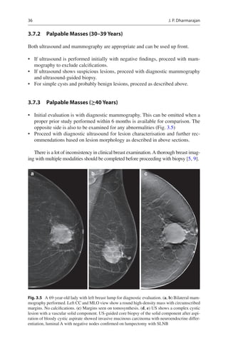 36
3.7.2 
Palpable Masses (30–39 Years)
Both ultrasound and mammography are appropriate and can be used up front.
• If ult...
