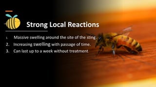 Strong Local Reactions
1. Massive swelling around the site of the sting.
2. Increasing swelling with passage of time.
3. Can last up to a week without treatment.
 