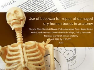 Use of beeswax for repair of damaged
dry human bones in anatomy
Shruthi Bhat, Sheela G Nayak, Vidhyashambava Pare, Sagar Borker
Kurinji Venkatramana Gowda Medical College, Sullia, Karnataka
National journal of clinical anatomy
Vol. 2(4), Pg: 200-203
2013
 