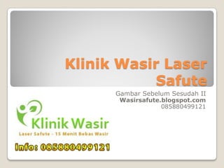 Klinik Wasir Laser
            Safute
      Gambar Sebelum Sesudah II
       Wasirsafute.blogspot.com
                   085880499121
 