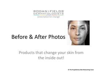 Before & After Photos Products that change your skin from the inside out! © The Propelled by Debi Networking Team 