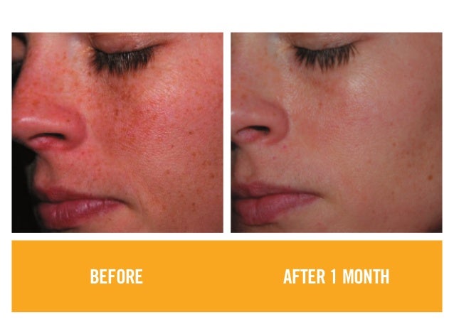  photos showcasing the powerful results of Rodan + Fields products
