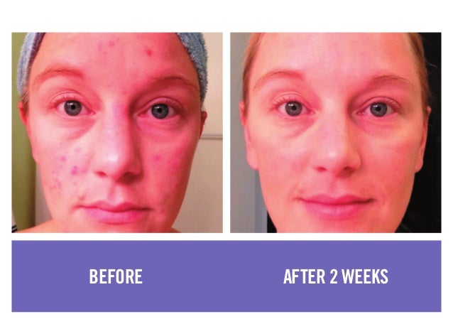 Before and After photos showcasing the powerful results of Rodan + Fi 