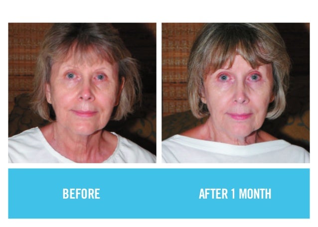 Before After Photos Showcasing Powerful Results Before After Photos Showcasing Powerful Results