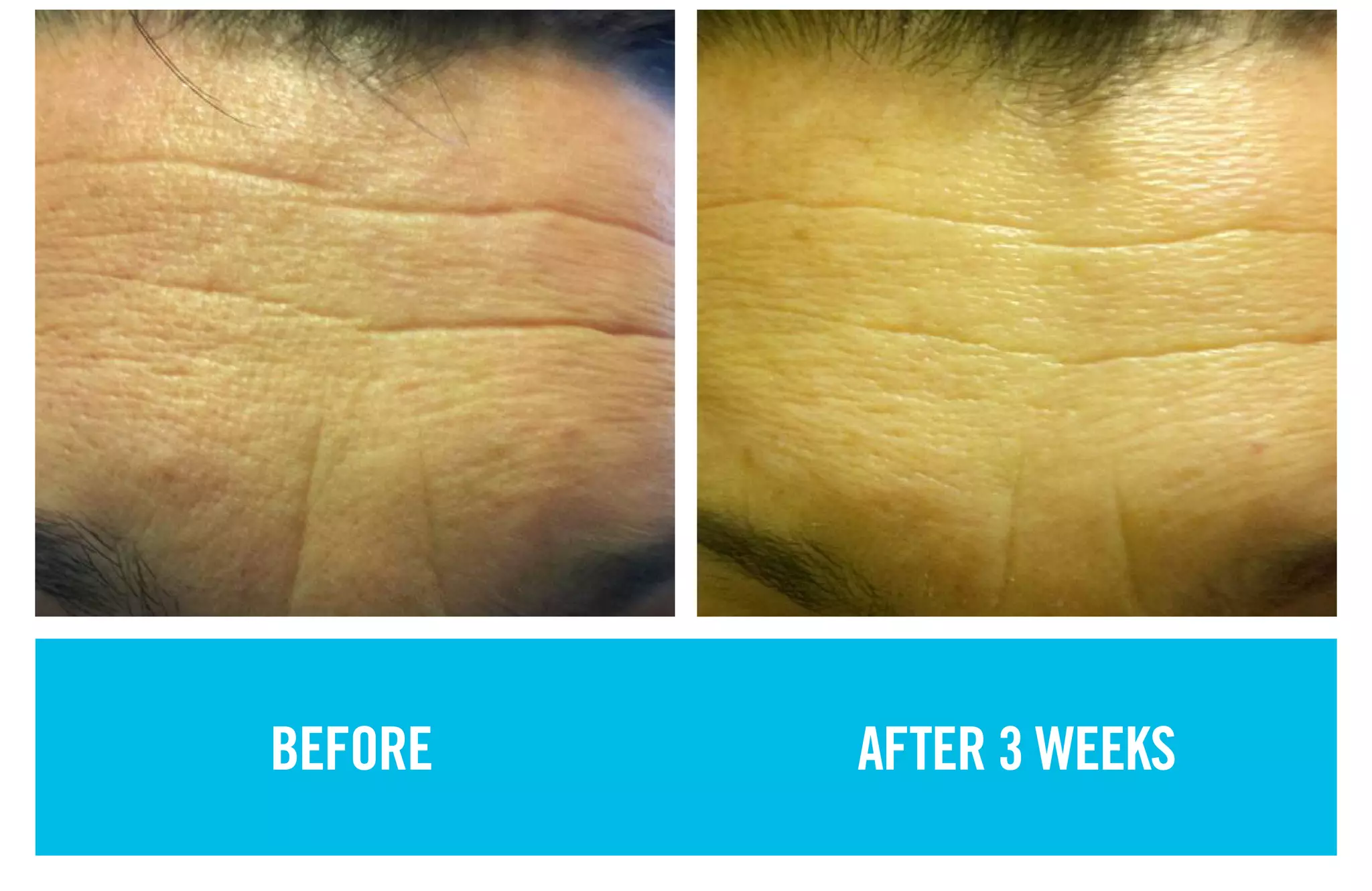 BEFORE AFTER 3 WEEKS
 