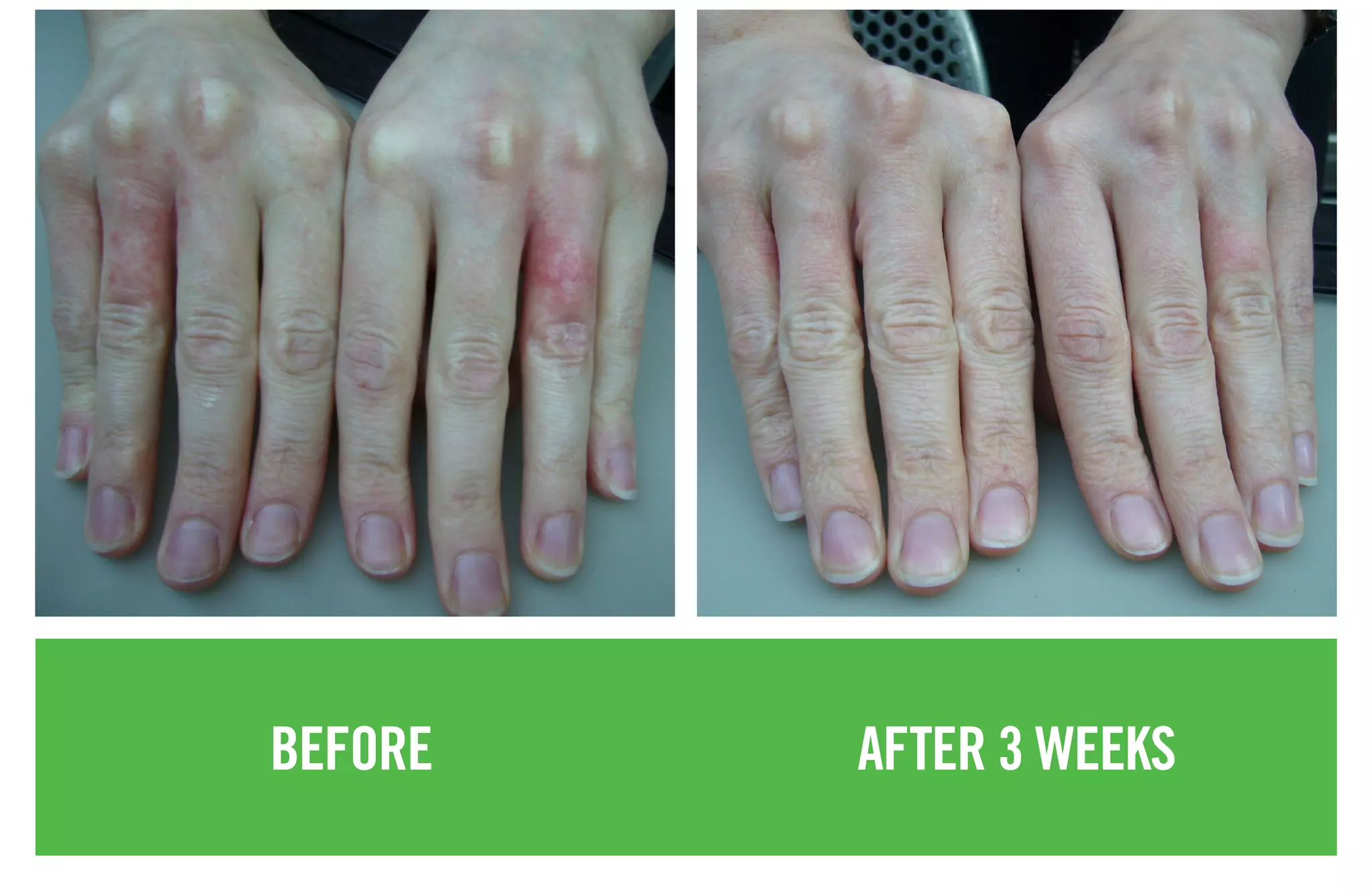 BEFORE AFTER 3 WEEKS
 