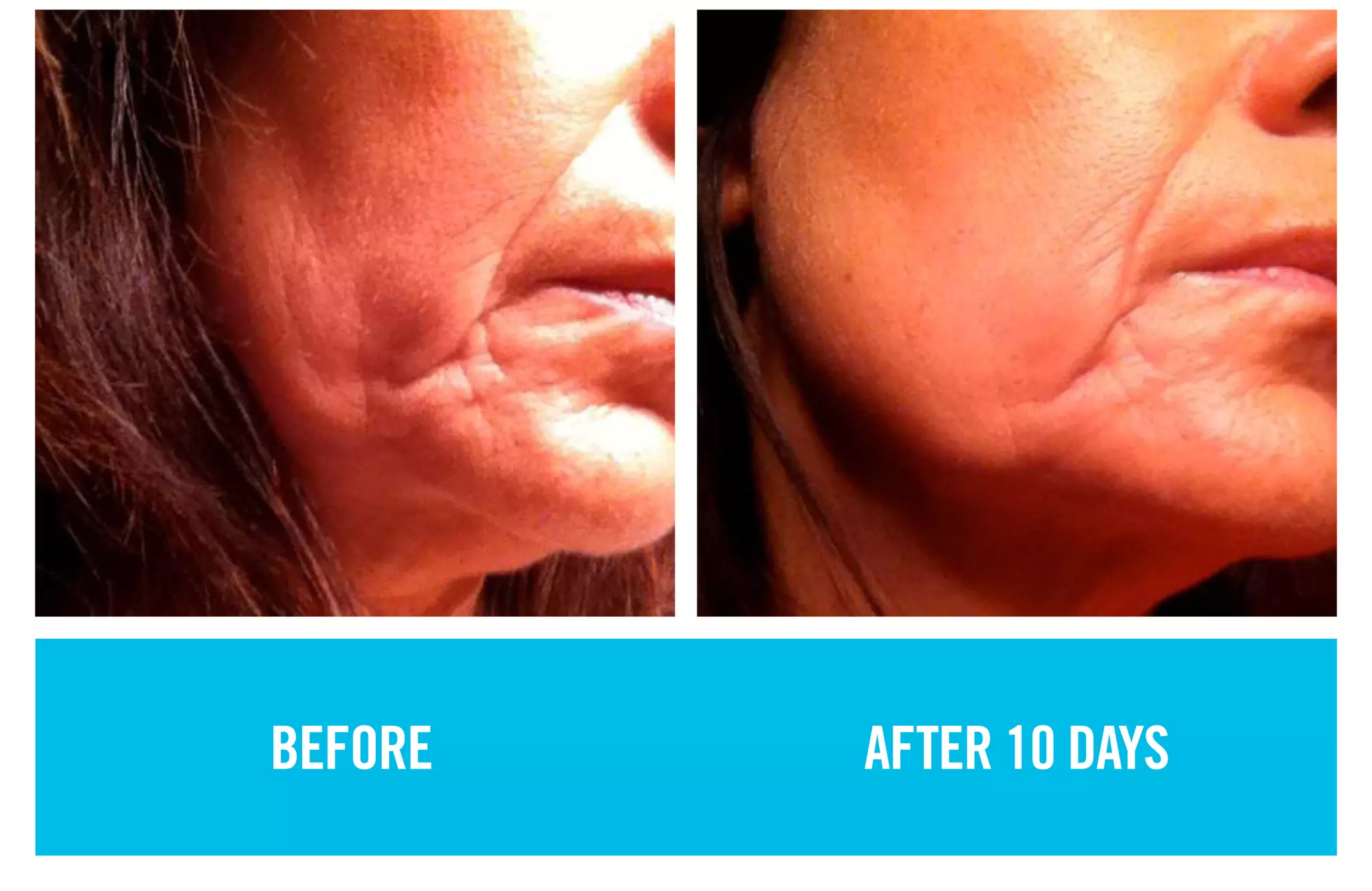 BEFORE AFTER 10 DAYS
 