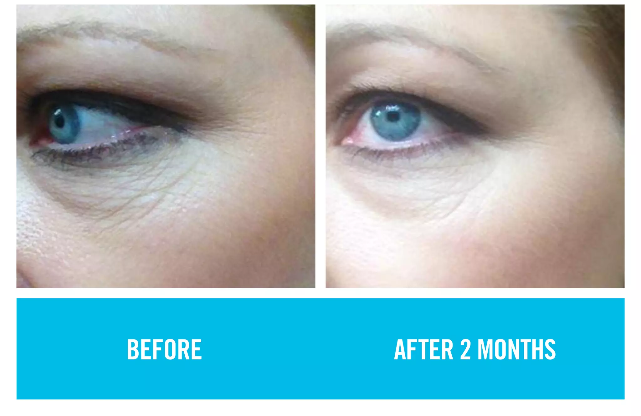 BEFORE AFTER 2 MONTHS
 