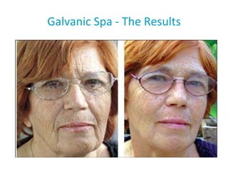 Galvanic Spa - The Results After four weeks of treatment 