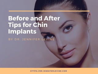 Before and After
Tips for Chin
Implants
B Y   D R . J E N N I F E R L E V I N E
H T T P S : / / D R . J E N N I F E R L E V I N E . C O M
 