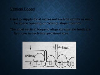 Vertical Loops
Used to supply local increased arch flexibility or used
for space opening or closing, stops, rotation.
The most vertical loops to align six anterior teeth are
five, one in each interproximal area.
 