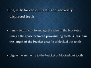Lingually locked out teeth and verticallyLingually locked out teeth and vertically
displaced teethdisplaced teeth
• It may be difficult to engage the wire in the brackets atIt may be difficult to engage the wire in the brackets at
times if thetimes if the space between proximating teeth is less thanspace between proximating teeth is less than
the length of the bracket areathe length of the bracket area for a blocked out toothfor a blocked out tooth
• Ligate the arch wire to the bracket of blocked out toothLigate the arch wire to the bracket of blocked out tooth
 