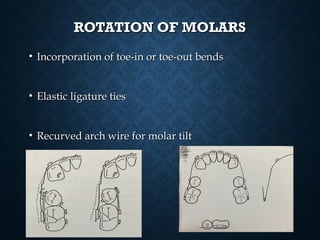 ROTATION OF MOLARSROTATION OF MOLARS
• Incorporation of toe-in or toe-out bendsIncorporation of toe-in or toe-out bends
• Elastic ligature tiesElastic ligature ties
• Recurved arch wire for molar tiltRecurved arch wire for molar tilt
 
